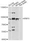 Ring Finger Protein 6 antibody, LS-C749575, Lifespan Biosciences, Western Blot image 