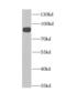 Hexose-6-Phosphate Dehydrogenase/Glucose 1-Dehydrogenase antibody, FNab03741, FineTest, Western Blot image 