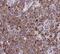Tubulin Alpha 1b antibody, FNab00333, FineTest, Immunohistochemistry paraffin image 