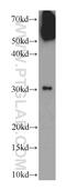 WD Repeat And SOCS Box Containing 1 antibody, 11666-1-AP, Proteintech Group, Western Blot image 