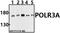 DNA-directed RNA polymerase III subunit RPC1 antibody, A06059-1, Boster Biological Technology, Western Blot image 