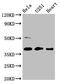 Reticulocalbin 3 antibody, CSB-PA856914LA01HU, Cusabio, Western Blot image 