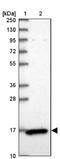 Coiled-Coil Domain Containing 58 antibody, NBP2-14452, Novus Biologicals, Western Blot image 