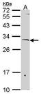 SURF1 Cytochrome C Oxidase Assembly Factor antibody, PA5-30187, Invitrogen Antibodies, Western Blot image 