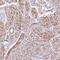 Smoothelin antibody, NBP2-37931, Novus Biologicals, Immunohistochemistry frozen image 