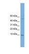 Cytochrome C Oxidase Subunit 7B antibody, NBP1-57028, Novus Biologicals, Western Blot image 