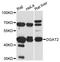 Diacylglycerol O-Acyltransferase 2 antibody, LS-C748911, Lifespan Biosciences, Western Blot image 