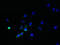 Succinate Dehydrogenase Complex Subunit C antibody, LS-C379215, Lifespan Biosciences, Immunofluorescence image 