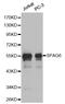 Sperm Associated Antigen 6 antibody, STJ113564, St John
