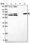 Zinc Finger Protein 510 antibody, PA5-61893, Invitrogen Antibodies, Western Blot image 