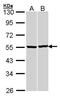 Tubulin Beta 1 Class VI antibody, orb74296, Biorbyt, Western Blot image 