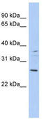 Achaete-Scute Family BHLH Transcription Factor 2 antibody, TA329753, Origene, Western Blot image 