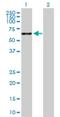 Transmembrane Phosphatase With Tensin Homology antibody, H00007179-B01P, Novus Biologicals, Western Blot image 