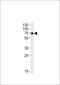 Kinesin Light Chain 1 antibody, MBS9201666, MyBioSource, Western Blot image 