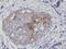 EGFR antibody, P00023-5, Boster Biological Technology, Immunohistochemistry frozen image 