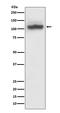 ATPase Sarcoplasmic/Endoplasmic Reticulum Ca2+ Transporting 2 antibody, M01176, Boster Biological Technology, Western Blot image 