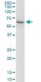 Stress Induced Phosphoprotein 1 antibody, H00010963-M35, Novus Biologicals, Western Blot image 