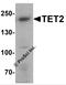 Tet Methylcytosine Dioxygenase 2 antibody, 7731, ProSci, Western Blot image 