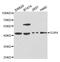 Gap Junction Protein Alpha 4 antibody, A2529, ABclonal Technology, Western Blot image 