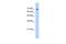 SURP And G-Patch Domain Containing 1 antibody, GTX47265, GeneTex, Western Blot image 