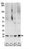 Small Nuclear Ribonucleoprotein D3 Polypeptide antibody, NBP2-22305, Novus Biologicals, Western Blot image 