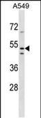 Transmembrane Protein 200A antibody, PA5-48755, Invitrogen Antibodies, Western Blot image 