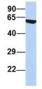 Transmembrane Protein 209 antibody, GTX44827, GeneTex, Western Blot image 