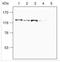 Sterol Regulatory Element Binding Transcription Factor 2 antibody, NBP1-54446, Novus Biologicals, Western Blot image 