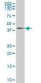 Metallophosphoesterase Domain Containing 2 antibody, H00000744-B01P, Novus Biologicals, Western Blot image 