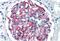Complement C3b/C4b Receptor 1 (Knops Blood Group) antibody, MBS245363, MyBioSource, Immunohistochemistry frozen image 