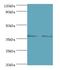 Mitogen-Activated Protein Kinase Kinase 3 antibody, LS-C376082, Lifespan Biosciences, Western Blot image 