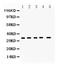Copper Chaperone For Superoxide Dismutase antibody, A00314-1, Boster Biological Technology, Western Blot image 