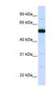 THUMP Domain Containing 2 antibody, NBP1-55086, Novus Biologicals, Western Blot image 