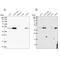 Zinc Finger DHHC-Type Containing 16 antibody, PA5-58965, Invitrogen Antibodies, Western Blot image 