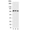 Cell Division Cycle 25A antibody, R30621, NSJ Bioreagents, Western Blot image 