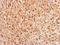 Proteasome 26S Subunit, ATPase 4 antibody, GTX114675, GeneTex, Immunohistochemistry paraffin image 