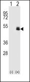 Paired Box 6 antibody, LS-C163395, Lifespan Biosciences, Western Blot image 