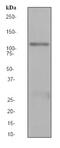 Phospholipase D1 antibody, ab68150, Abcam, Western Blot image 