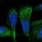 Zinc Finger CCCH-Type Containing 7A antibody, NBP2-56811, Novus Biologicals, Immunofluorescence image 