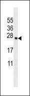 Transmembrane Protein 18 antibody, LS-C162031, Lifespan Biosciences, Western Blot image 