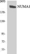 Nuclear Mitotic Apparatus Protein 1 antibody, LS-B11432, Lifespan Biosciences, Western Blot image 