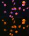 Protein Kinase CAMP-Dependent Type II Regulatory Subunit Alpha antibody, GTX35228, GeneTex, Immunofluorescence image 