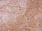 Thymidine Kinase 1 antibody, PA5-29686, Invitrogen Antibodies, Immunohistochemistry frozen image 