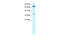 NFKB Inhibitor Beta antibody, 28-111, ProSci, Western Blot image 