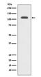 Phosphoribosylglycinamide Formyltransferase, Phosphoribosylglycinamide Synthetase, Phosphoribosylaminoimidazole Synthetase antibody, M06061, Boster Biological Technology, Western Blot image 