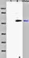 Forkhead Box E1 antibody, orb11534, Biorbyt, Western Blot image 