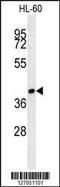 ST8 Alpha-N-Acetyl-Neuraminide Alpha-2,8-Sialyltransferase 3 antibody, 61-983, ProSci, Western Blot image 