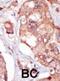 Non-receptor tyrosine-protein kinase TNK1 antibody, abx025131, Abbexa, Immunohistochemistry paraffin image 