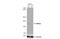 Bone Morphogenetic Protein Receptor Type 2 antibody, NBP1-32218, Novus Biologicals, Western Blot image 