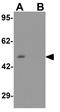 Adhesion Regulating Molecule 1 antibody, GTX17239, GeneTex, Western Blot image 